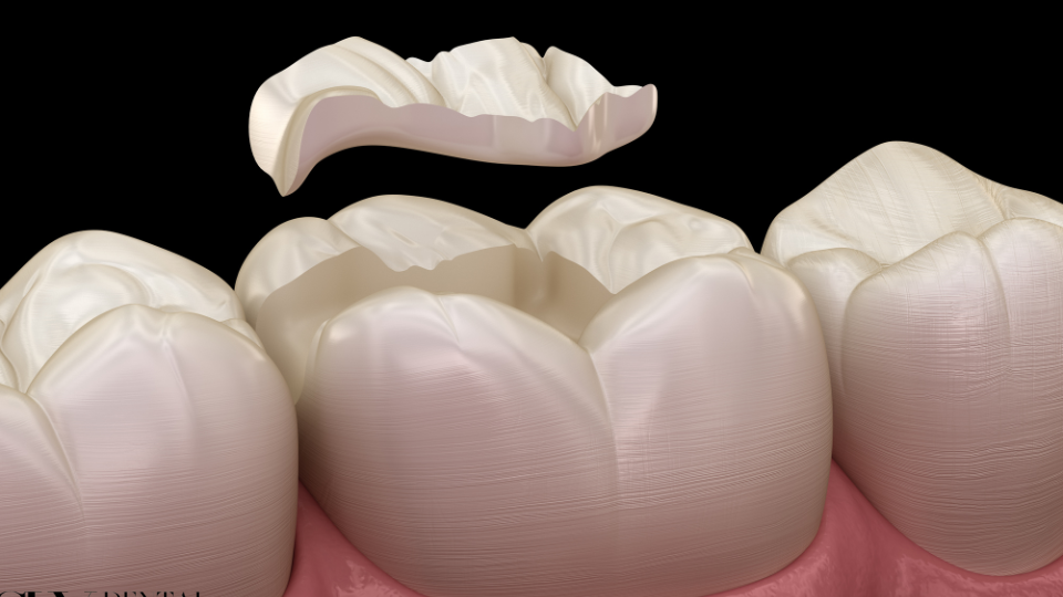 sky-dental-36