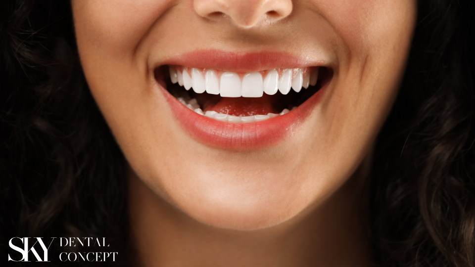 dental prosthetic