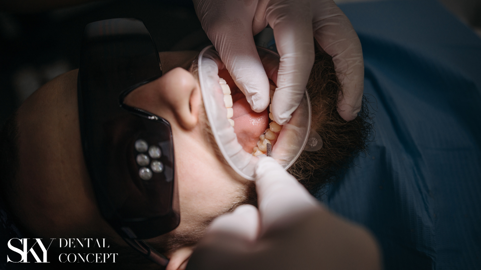 general anesthesia